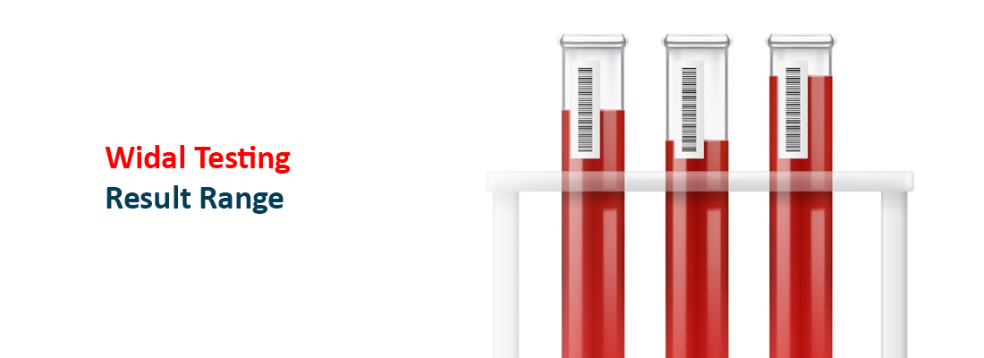  Methods of Widal Testing